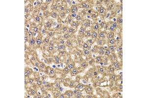 Immunohistochemistry of paraffin-embedded rat liver using UBE2J2 antibody (ABIN5974418) at dilution of 1/100 (40x lens). (UBE2J2 抗体)