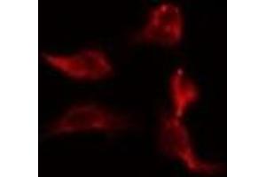 ABIN6278357 staining Hela by IF/ICC. (CARD9 抗体  (C-Term))