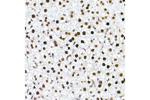 Immunohistochemistry of paraffin-embedded mouse liver using RBM3 Rabbit mAb (ABIN7270084) at dilution of 1:25 (40x lens). (RBM3 抗体)