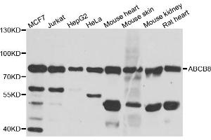 Western blot analysis of extracts of various cell lines, using ABCB8 antibody (ABIN5974712) at 1/1000 dilution. (ABCB8 抗体)