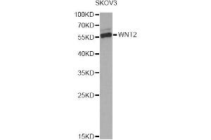 Western blot analysis of extracts of SKOV3 cells, using WNT2 Antibody. (WNT2 抗体)