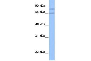 WB Suggested Anti-OXCT2 Antibody Titration:  0. (OXCT2 抗体  (Middle Region))