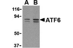 Western Blotting (WB) image for anti-Activating Transcription Factor 6 (ATF6) (C-Term) antibody (ABIN1030261) (ATF6 抗体  (C-Term))