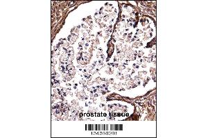 DSG2 Antibody immunohistochemistry analysis in formalin fixed and paraffin embedded human prostate tissue followed by peroxidase conjugation of the secondary antibody and DAB staining. (Desmoglein 2 抗体  (C-Term))
