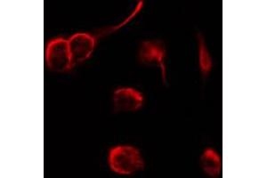 ABIN6266562 staining SKOV3 by IF/ICC. (Neuregulin 1 抗体  (N-Term))