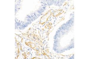 Immunohistochemistry (IHC) image for anti-Decorin (DCN) (AA 31-359) antibody (ABIN3022361)