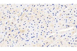 Detection of PLOD1 in Human Cardiac Muscle Tissue using Polyclonal Antibody to Procollagen Lysine-1,2-Oxoglutarate-5-Dioxygenase 1 (PLOD1) (PLOD1 抗体  (AA 636-727))