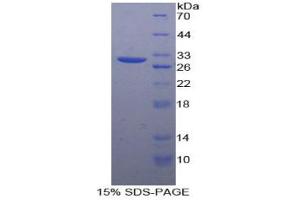 SDS-PAGE analysis of Human Connexin 37 Protein. (GJA4 蛋白)