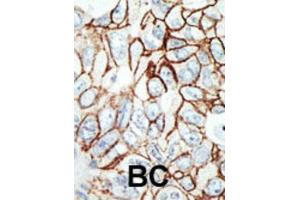 Immunohistochemistry (IHC) image for anti-Histone Deacetylase 11 (HDAC11) antibody (ABIN2996030) (HDAC11 抗体)