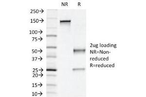 SDS-PAGE Analysis of Purified, BSA-Free Napsin A Antibody (clone NAPSA/1239).