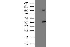 Western Blotting (WB) image for anti-Proteasome (Prosome, Macropain) 26S Subunit, Non-ATPase, 2 (PSMD2) antibody (ABIN1500479) (PSMD2 抗体)