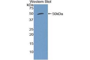 Western Blotting (WB) image for anti-Mucin 1 (MUC1) (AA 474-630) antibody (ABIN1859903) (MUC1 抗体  (AA 474-630))