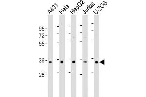 All lanes : Anti-RNPS1 Antibody (N-Term) at 1:500-1:1000 dilution Lane 1: A431 whole cell lysate Lane 2: Hela whole cell lysate Lane 3: HepG2 whole cell lysate Lane 4: Jurkat whole cell lysate Lane 5: U-2OS whole cell lysate Lysates/proteins at 20 μg per lane. (RNPS1 抗体  (AA 11-44))