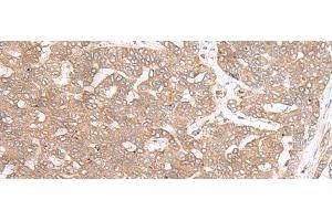 Immunohistochemistry (Paraffin-embedded Sections) (IHC (p)) image for anti-Protein Tyrosine Phosphatase Type IVA, Member 3 (PTP4A3) antibody (ABIN7246463)