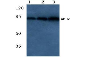Western blot analysis of Beta-Adducin Antibody at 1/500 dilution. (ADD2 抗体)