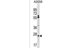 CNPY3 Antibody (N-term) (ABIN1539523 and ABIN2850084) western blot analysis in  cell line lysates (35 μg/lane). (TNRC5 抗体  (N-Term))