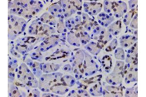 Immunohistochemistry (IHC) image for anti-Cofilin 1 (CFL1) (pSer3) antibody (ABIN6255180)