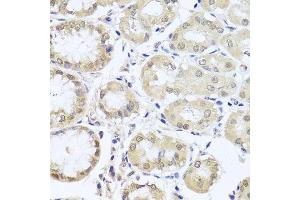 Immunohistochemistry (Paraffin-embedded Sections) (IHC (p)) image for anti-Chorionic Gonadotropin, beta Polypeptide 7 (CGB7) (AA 21-165) antibody (ABIN6138476)