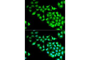 Immunofluorescence analysis of MCF-7 cell using RNGTT antibody. (RNGTT 抗体)