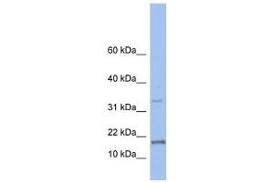 TCL1A antibody used at 1 ug/ml to detect target protein. (TCL1A 抗体  (N-Term))