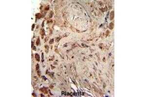 Immunohistochemistry (IHC) image for anti-Protein Kinase, Interferon-Inducible Double Stranded RNA Dependent Activator (PRKRA) antibody (ABIN3003466) (PRKRA 抗体)