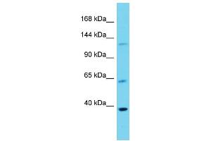 Host: Rabbit  Target Name: Dlg3  Sample Tissue: Mouse Lung lysates  Antibody Dilution: 1. (DLG3 抗体  (Middle Region))