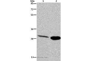 Western blot analysis of Human hepatocellular carcinoma and mouse skeletal muscle tissue, using CA3 Polyclonal Antibody at dilution of 1:200 (CA3 抗体)