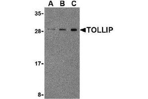 Western blot analysis of TOLLIP in Rat brain cell lysate with AP30928PU-N TOLLIP antibody at 0. (TOLLIP 抗体  (Center))