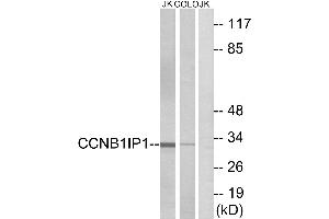 Western blot analysis of extracts from Jurkat cells and COLO cells, using CCNB1IP1 antibody. (CCNB1IP1 抗体)