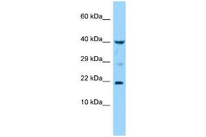 Host: Rabbit Target Name: IL36G Sample Type: THP-1 Whole Cell lysates Antibody Dilution: 1. (IL1F9 抗体  (Middle Region))