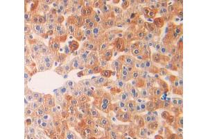 IHC-P analysis of liver tissue, with DAB staining. (IL18R1 抗体  (AA 391-518))
