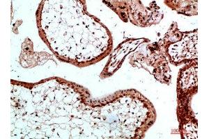 Immunohistochemical analysis of paraffin-embedded human-placenta, antibody was diluted at 1:200 (Ubiquitin B 抗体)