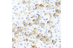 Immunohistochemistry of paraffin-embedded rat liver using F3 antibody at dilution of 1:100 (x40 lens). (Tissue factor 抗体)
