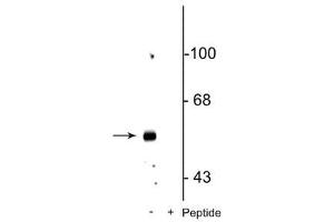 Western Blotting (WB) image for anti-gamma-aminobutyric Acid (GABA) A Receptor, beta 3 (GABRB3) (pSer408), (pSer409) antibody (ABIN6254101)