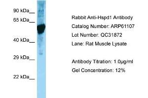 Western Blotting (WB) image for anti-Heat Shock 60kDa Protein 1 (Chaperonin) (HSPD1) (C-Term) antibody (ABIN970918) (HSPD1 抗体  (C-Term))