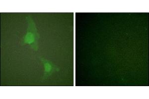 Immunofluorescence analysis of HeLa cells, using ADD1 (Ab-726) antibody. (alpha Adducin 抗体)
