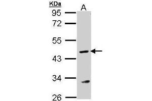 WB Image Sample (30 ug of whole cell lysate) A: MOLT4 , 10% SDS PAGE antibody diluted at 1:1000 (ASL 抗体)
