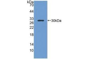 Detection of Recombinant IGFBP1, Human using Polyclonal Antibody to Insulin Like Growth Factor Binding Protein 1 (IGFBP1) (IGFBPI 抗体  (AA 36-235))