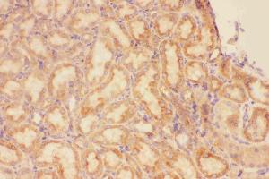 Anti-CXCR3 Picoband antibody, IHC(P): Rat Kidney Tissue (CXCR3 抗体  (AA 1-368))