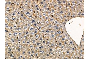 ABIN6258935 and ABIN6275451 at 1/100 staining mouse liver tissue by IHC-P. (G3BP2 抗体  (C-Term))