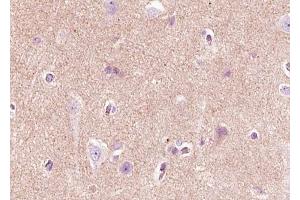 ABIN6268720 at 1/100 staining human brain tissue sections by IHC-P.