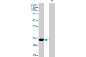 Western Blot analysis of PPP1R2P9 expression in transfected 293T cell line by PPP1R2P9 MaxPab polyclonal antibody. (PPP1R2P9 抗体  (AA 1-202))