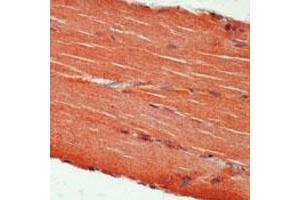 Formalin-fixed, paraffin-embedded human skeletal muscle stained with c-erbB3 Ab using peroxidase-conjugate and AEC chromogen.