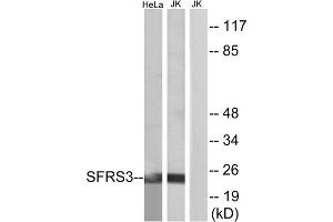 Western blot analysis of extracts from HeLa cells and Jurkat cells, using SFRS3 antibody. (SRSF3 抗体  (C-Term))