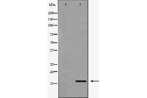Western blot analysis of extracts of NCI-H460, using CST3 antibody. (CST3 抗体)