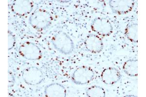 Immunohistochemistry (IHC) image for anti-SRY (Sex Determining Region Y)-Box 4 (SOX4) antibody (ABIN6940617)