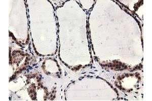 Immunohistochemistry (IHC) image for anti-COBW Domain Containing 1 (CBWD1) antibody (ABIN1497117) (CBWD1 抗体)