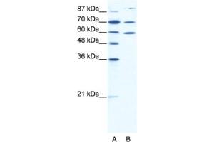 Western Blotting (WB) image for anti-Heat Shock Protein 90kDa alpha (Cytosolic), Class B Member 1 (HSP90AB1) antibody (ABIN2463708)