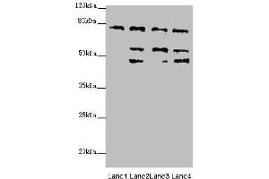 Western blot analysis of (1) HeLa whole cell lysates, (2) 293T whole cell lysates, (3) Mouse liver tissue, and (4) Mouse kidney tissue, using ZFYVE1 antibody (6. (ZFYVE1 抗体  (AA 1-280))