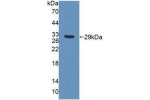 Detection of Recombinant MYH6, Rat using Polyclonal Antibody to Myosin Heavy Chain 6, Cardiac Muscle, Alpha (MYH6)